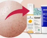 Skóra z widocznymi porami i włóknami łojowymi, obok kosmetyki do pielęgnacji: pianka Orientana, peeling Isana i krem Skinimal.