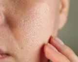 Zbliżenie na skórę z widocznymi porami, które mogą być wypełnione sebum. Dłoń delikatnie dotyka policzka.