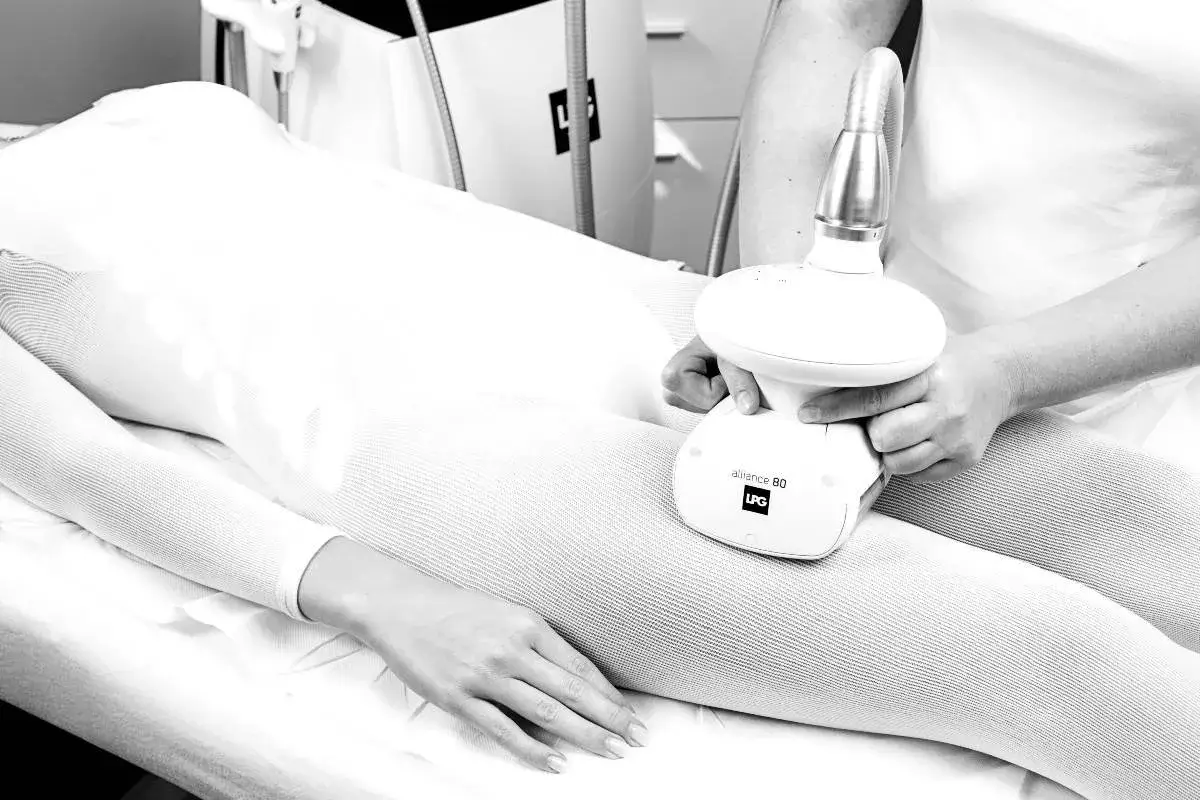 kobieta na zabiegu endermologii